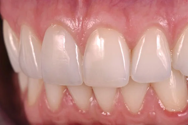 Obere und untere Zahnreihe